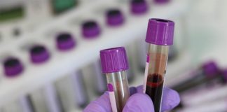 Un nuevo análisis de sangre puede identificar si un paciente tiene cáncer y si se ha extendido Un nuevo análisis de sangre puede identificar si un paciente tiene cáncer y si se ha extendido