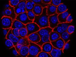 Las células de cáncer de páncreas se alimentan de ácido hialurónico Células de cáncer de páncreas (azul) creciendo como una esfera encerrada en membranas (roja)