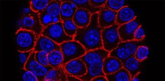 Las células de cáncer de páncreas se alimentan de ácido hialurónico Células de cáncer de páncreas (azul) creciendo como una esfera encerrada en membranas (roja)