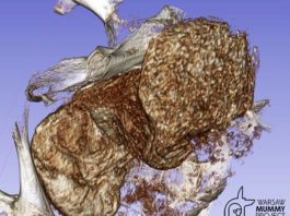 Cómo se conservó el feto encontrado dentro de una antigua momia egipcia Feto escabechado encontrado dentro de una antigua momia egipcia