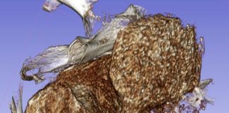 Cómo se conservó el feto encontrado dentro de una antigua momia egipcia Feto escabechado encontrado dentro de una antigua momia egipcia