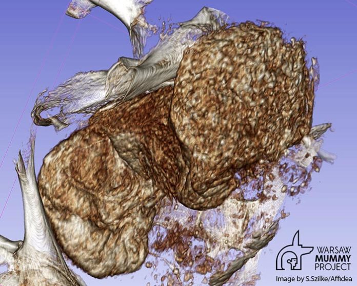 Feto escabechado encontrado dentro de una antigua momia egipcia