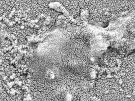 Nuevo método puede desarmar la resistencia a los antibióticos en bacterias mortales Una bacteria resistente a los antibióticos (Klebsiella pneumoniae) se trata con un antibiótico y un inhibidor de DsbA, lo que hace que colapse y muera