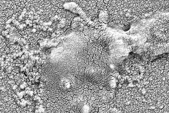 Una bacteria resistente a los antibióticos (Klebsiella pneumoniae) se trata con un antibiótico y un inhibidor de DsbA, lo que hace que colapse y muera Una bacteria resistente a los antibióticos (Klebsiella pneumoniae) se trata con un antibiótico y un inhibidor de DsbA, lo que hace que colapse y muera
