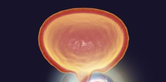 Combinación de tres fármacos prolonga la supervivencia en hombres con cáncer de próstata metastásico sensible a hormonas Cáncer de próstata