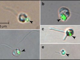 El fitoplancton depredador es clave para comprender el ecosistema oceánico Las cuentas verdes (puntas de flecha) imitan a las bacterias; visto dentro del fitoplancton después de comer cuentas