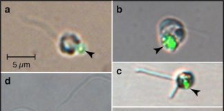 El fitoplancton depredador es clave para comprender el ecosistema oceánico Las cuentas verdes (puntas de flecha) imitan a las bacterias; visto dentro del fitoplancton después de comer cuentas