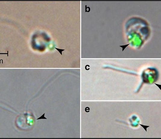 El fitoplancton depredador es clave para comprender el ecosistema oceánico Las cuentas verdes (puntas de flecha) imitan a las bacterias; visto dentro del fitoplancton después de comer cuentas