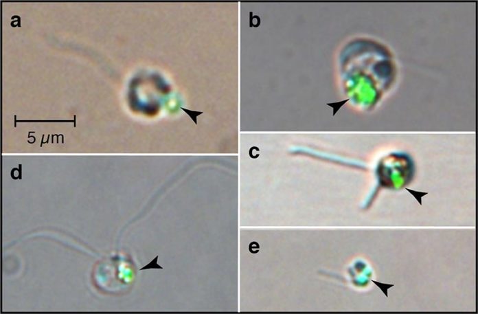 Las cuentas verdes (puntas de flecha) imitan a las bacterias; visto dentro del fitoplancton después de comer cuentas