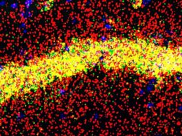 Nuevo mecanismo implicado en el aprendizaje y la memoria relacionado con FMRP La proteína FMRP realiza diferentes funciones en los cuerpos celulares (amarillo) y las dendritas (rojo) de las neuronas de memoria del hipocampo