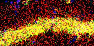 Nuevo mecanismo implicado en el aprendizaje y la memoria relacionado con FMRP La proteína FMRP realiza diferentes funciones en los cuerpos celulares (amarillo) y las dendritas (rojo) de las neuronas de memoria del hipocampo