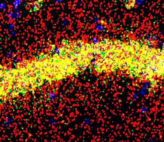 Nuevo mecanismo implicado en el aprendizaje y la memoria relacionado con FMRP La proteína FMRP realiza diferentes funciones en los cuerpos celulares (amarillo) y las dendritas (rojo) de las neuronas de memoria del hipocampo