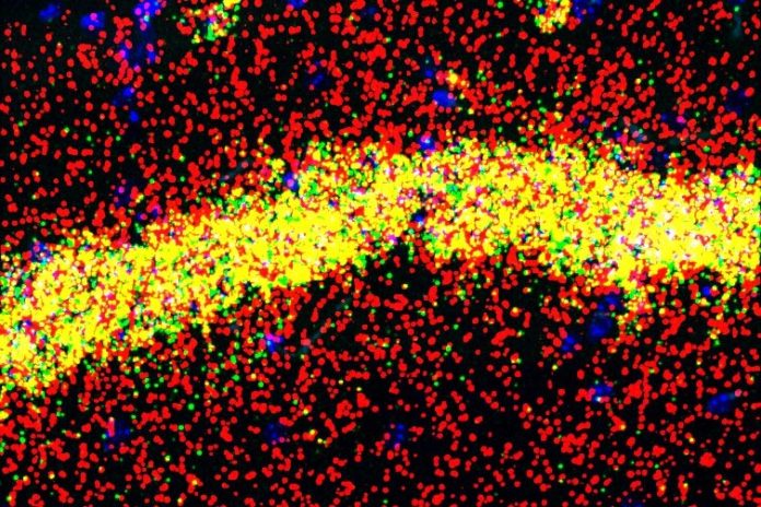 La proteína FMRP realiza diferentes funciones en los cuerpos celulares (amarillo) y las dendritas (rojo) de las neuronas de memoria del hipocampo La proteína FMRP realiza diferentes funciones en los cuerpos celulares (amarillo) y las dendritas (rojo) de las neuronas de memoria del hipocampo