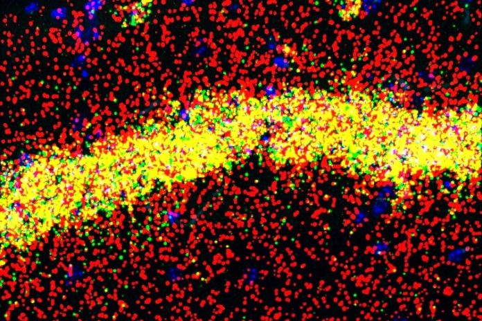 La proteína FMRP realiza diferentes funciones en los cuerpos celulares (amarillo) y las dendritas (rojo) de las neuronas de memoria del hipocampo