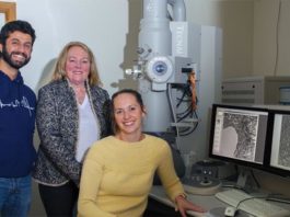 El Alzheimer provoca cambios en los pequeños vasos sanguíneos del cerebro Alzheimer: Investigaciones anteriores han demostrado que varios de los mismos factores de riesgo detrás del desarrollo de enfermedades cardiovasculares también pueden conducir a esta enfermedad