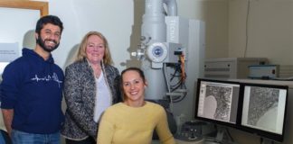 El Alzheimer provoca cambios en los pequeños vasos sanguíneos del cerebro Alzheimer: Investigaciones anteriores han demostrado que varios de los mismos factores de riesgo detrás del desarrollo de enfermedades cardiovasculares también pueden conducir a esta enfermedad