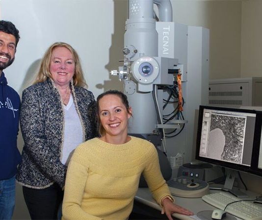 El Alzheimer provoca cambios en los pequeños vasos sanguíneos del cerebro Alzheimer: Investigaciones anteriores han demostrado que varios de los mismos factores de riesgo detrás del desarrollo de enfermedades cardiovasculares también pueden conducir a esta enfermedad