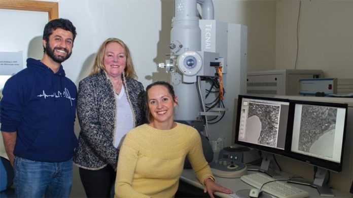 Alzheimer: Investigaciones anteriores han demostrado que varios de los mismos factores de riesgo detrás del desarrollo de enfermedades cardiovasculares también pueden conducir a esta enfermedad Alzheimer: Investigaciones anteriores han demostrado que varios de los mismos factores de riesgo detrás del desarrollo de enfermedades cardiovasculares también pueden conducir a esta enfermedad