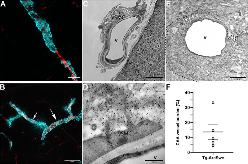 Aβ se acumula en las arteriolas leptomeníngeas y penetrantes y alrededor de los capilares en Tg-ArcSwe Aβ se acumula en las arteriolas leptomeníngeas y penetrantes y alrededor de los capilares en Tg-ArcSwe