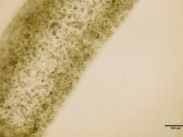 Investigadores descubren cómo imprimir células testiculares en 3D 12 días después de la impresión, el equipo descubrió que las células testiculares no sólo habían sobrevivido, sino que también habían madurado hasta convertirse en varias de las células especializadas involucradas en la producción de esperma