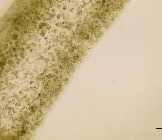 Investigadores descubren cómo imprimir células testiculares en 3D 12 días después de la impresión, el equipo descubrió que las células testiculares no sólo habían sobrevivido, sino que también habían madurado hasta convertirse en varias de las células especializadas involucradas en la producción de esperma