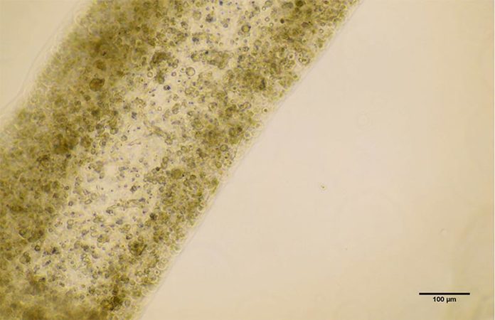 12 días después de la impresión, el equipo descubrió que las células testiculares no sólo habían sobrevivido, sino que también habían madurado hasta convertirse en varias de las células especializadas involucradas en la producción de esperma