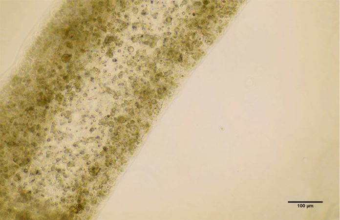 12 días después de la impresión, el equipo descubrió que las células testiculares no sólo habían sobrevivido, sino que también habían madurado hasta convertirse en varias de las células especializadas involucradas en la producción de esperma 12 días después de la impresión, el equipo descubrió que las células testiculares no sólo habían sobrevivido, sino que también habían madurado hasta convertirse en varias de las células especializadas involucradas en la producción de esperma