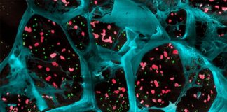 Gel biodegradable aumenta la respuesta del sistema inmunológico contra varios tipos de cáncer en ratones Una gran ampliación del hidrogel (en azul) que encapsula las plaquetas que activan las células T (en rojo) y las nanopartículas que liberan un fármaco para inhibir las células que estimulan los tumores en el cáncer (en verde)