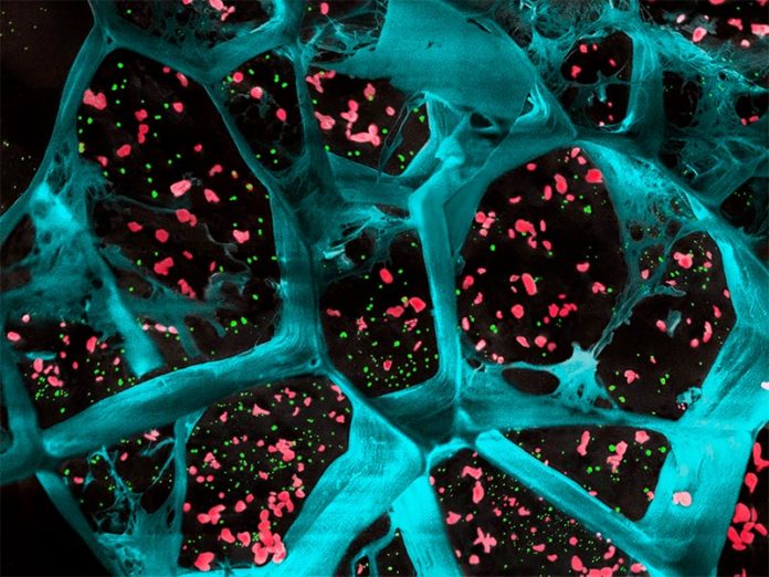 Una gran ampliación del hidrogel (en azul) que encapsula las plaquetas que activan las células T (en rojo) y las nanopartículas que liberan un fármaco para inhibir las células que estimulan los tumores en el cáncer (en verde) Una gran ampliación del hidrogel (en azul) que encapsula las plaquetas que activan las células T (en rojo) y las nanopartículas que liberan un fármaco para inhibir las células que estimulan los tumores en el cáncer (en verde)