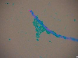 Los patógenos pueden viajar en microplásticos para llegar al mar Trozo de fibra microplástica bajo un microscopio con biopelícula (azul borroso) y patógenos T. gondii (punto azul) y giardia (punto verde)