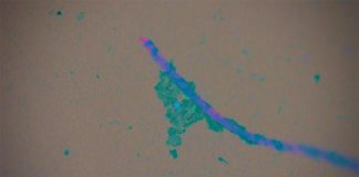 Los patógenos pueden viajar en microplásticos para llegar al mar Trozo de fibra microplástica bajo un microscopio con biopelícula (azul borroso) y patógenos T. gondii (punto azul) y giardia (punto verde)