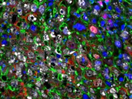 Terapia de regeneración celular restaura tejido hepático dañado más rápido que nunca Regeneración celular: Las células hepáticas se reprogramaron parcialmente en células más jóvenes (rojas) usando factores de Yamanaka (blanco)