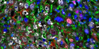 Terapia de regeneración celular restaura tejido hepático dañado más rápido que nunca Regeneración celular: Las células hepáticas se reprogramaron parcialmente en células más jóvenes (rojas) usando factores de Yamanaka (blanco)