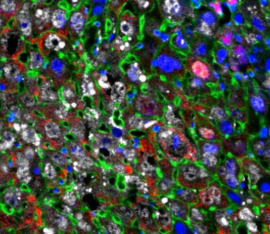 Terapia de regeneración celular restaura tejido hepático dañado más rápido que nunca Regeneración celular: Las células hepáticas se reprogramaron parcialmente en células más jóvenes (rojas) usando factores de Yamanaka (blanco)