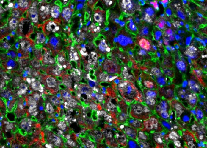 Regeneración celular: Las células hepáticas se reprogramaron parcialmente en células más jóvenes (rojas) usando factores de Yamanaka (blanco)