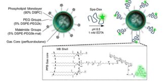 Las microburbujas guiadas por ultrasonido aumentan la eficacia de la inmunoterapia Las microburbujas guiadas por ultrasonido aumentan la eficacia de la inmunoterapia