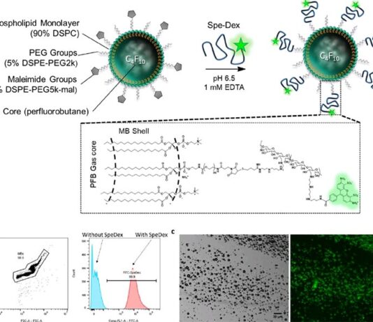 Las microburbujas guiadas por ultrasonido aumentan la eficacia de la inmunoterapia Las microburbujas guiadas por ultrasonido aumentan la eficacia de la inmunoterapia