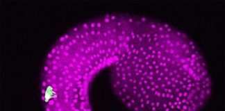 Identifican un importante origen genético de nuestros sentidos Un embrión del tunicado Ciona intestinalis. La imagen del microscopio muestra neuronas bipolares de la cola en la región de la cola (verde) y células epidérmicas (magenta)