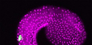 Un embrión del tunicado Ciona intestinalis. La imagen del microscopio muestra neuronas bipolares de la cola en la región de la cola (verde) y células epidérmicas (magenta)