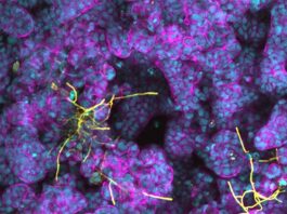 Células intestinales y bacterias del ácido láctico protegen contra las infecciones por Candida Candida albicans (amarillo) formando hifas en células epiteliales intestinales diferenciadas