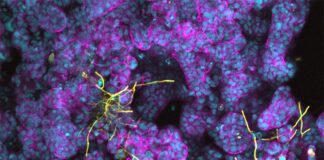 Células intestinales y bacterias del ácido láctico protegen contra las infecciones por Candida Candida albicans (amarillo) formando hifas en células epiteliales intestinales diferenciadas