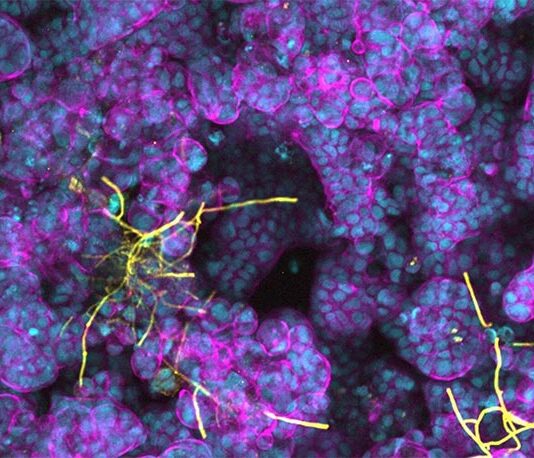 Células intestinales y bacterias del ácido láctico protegen contra las infecciones por Candida Candida albicans (amarillo) formando hifas en células epiteliales intestinales diferenciadas