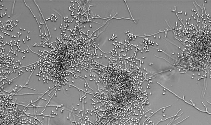 Candida albicans cambia de hifa a levadura cuando crece en medio de cultivo celular