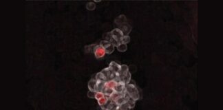 Un nuevo estudio mejora la comprensión de cómo se forma la sangre Génesis de la sangre: Grupos de las primeras células hematopoyéticas que nacen en las paredes de la arteria umbilical de un embrión de ratón. Las células coloreadas en rojo representan células progenitoras multipotentes embrionarias (eMPP)