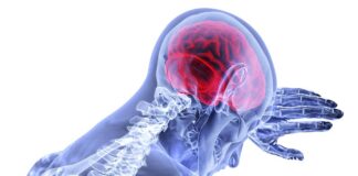 Incluso completar las tareas del hogar disminuye las posibilidades de ictus Ictus