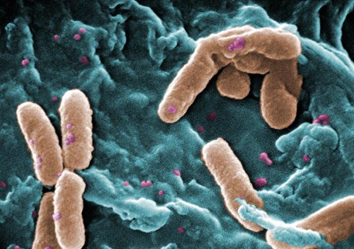 Superbacterias: Imagen de la Bacteria Pseudomonas aeruginosa