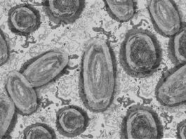 La viruela del mono está mutando a un ritmo más rápido de lo esperado Viruela del mono