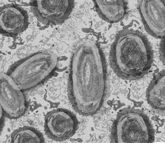 La viruela del mono está mutando a un ritmo más rápido de lo esperado Viruela del mono
