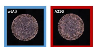 Un péptido permite la detección temprana del Alzheimer con un 99% de efectividad Alzheimer: Las redes neuronales pueden detectar diferencias mínimas en los patrones de tinción de las soluciones de péptidos secos