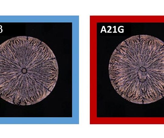 Un péptido permite la detección temprana del Alzheimer con un 99% de efectividad Alzheimer: Las redes neuronales pueden detectar diferencias mínimas en los patrones de tinción de las soluciones de péptidos secos
